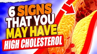 High Cholesterol Alert 6 Symptoms You Shouldnt Ignore [upl. by Merrie592]