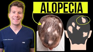 Hair fall Treatment  Hair Loss Treatment for Men  How to stop hair fall  Hair RegrowthNUTRIENTS [upl. by Htebzil]