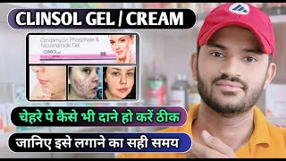 Clinsol gel how to use full review in hindi [upl. by Ekul]