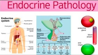 Endocrine Pathoma 6Last  Adrenal Cortex amp Adrenal Medulla [upl. by Neladgam578]