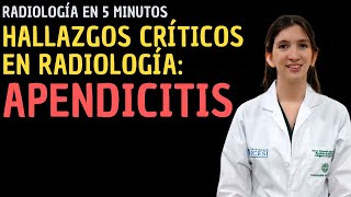 Radiología en 5 minutos Hallazgos críticos en Radiología  Apendicitis [upl. by Eilrebma26]