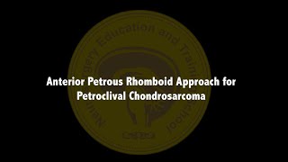 Anterior Petrous Rhomboid Approach for Petroclival Chondrosarcoma [upl. by Elise]