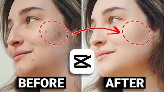 How To Remove Pimples Blemishes From Video Fast  Skin Retouch CapCut Tutorial [upl. by Hau]