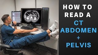 Radiology How to Read a CT Abdomen amp Pelvis My search pattern [upl. by Nylqcaj]