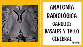 Anatomía Radiológica Ganglios basales y tallo cerebral [upl. by Candis]