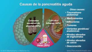 Pancreatitis aguda [upl. by Cassaundra808]