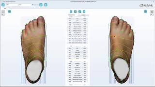 UPODS 3D Laser Full Foot Scanner [upl. by Marieann174]