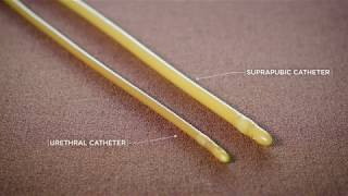 What Is a Suprapubic Catheter [upl. by Gwennie546]