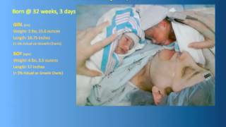 14 Help Premature Babies amp Improve Neuromuscular Symptoms in Children wMicronutrients [upl. by Mani]