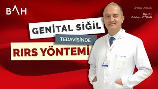 Genital Siğil Tedavisinde Radyofrekans Yöntemi [upl. by Omsoc769]