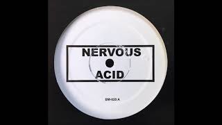 BOBBY KONDERS  NERVOUS ACID [upl. by Woolley644]