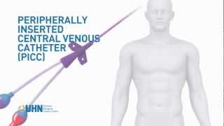 Learn About the Peripherally Inserted Central Venous Catheter PICC [upl. by Egroj107]