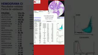 Interpreta el siguiente hemograma hematologia medicina [upl. by Htims]