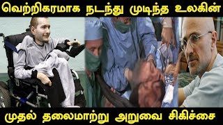 வெற்றிகரமாக நடந்து முடிந்த உலகின் முதல் தலைமாற்று அறுவை சிகிச்சை  Worlds First head Transplant [upl. by Julie]