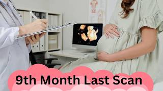 9th Month Pregnancy Ultrasound Last Scan Before Baby’s Arrival pregnancy pregnant dailyvlog [upl. by Marela]