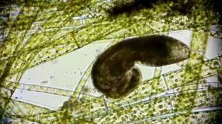 🔬 nematode  microorganism under microscope  in a drop of water Leben im Wassertropfen microcosmos [upl. by Relda210]