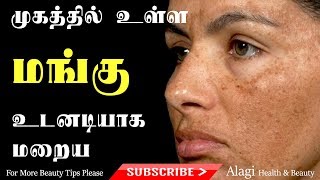 முகத்தில் உள்ள மங்கு உடனடியாக மறைய  How to cure ManguMelasmaPigmentation  Alagi Beauty Tips [upl. by Artinek490]