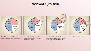 Intro to EKG Interpretation  Rate and Axis [upl. by Avla]