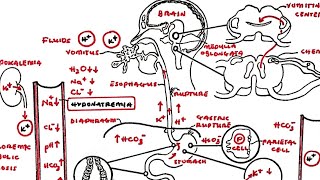 Explanation Of Vomiting  Side Effects  Pathophysiology illustration  A Condensed Summary [upl. by Aneek]