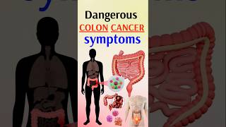 Cancer Symptoms You Should NEVER Ignore [upl. by Naillij384]