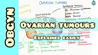 Ovarian Tumorsclassification easy mnemonic for USMLE [upl. by Desberg]