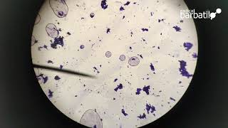 Observación de bacterias de yogur al microscopio [upl. by Lacim]