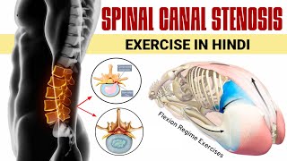 Spinal canal stenosis exercises in hindi  6 best lumbar canal stenosis exercises in hindi [upl. by Trebliw]