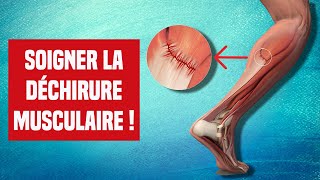 SOIGNER UNE DÉCHIRURE MUSCULAIRE  EXPLICATION ET TRAITEMENT [upl. by Etnaik]