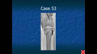 RADIOLOGY EXAM CASES [upl. by Ahsoik]