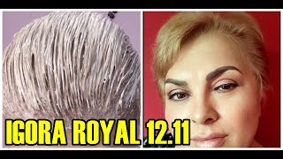 IGORA ROYAL 1211 ESSA É A TINTA QUE USO MO MEU CABELO [upl. by Adnahcir]