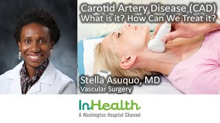 Carotid Artery Disease CAD What Is It How Can We Treat It [upl. by Lias]