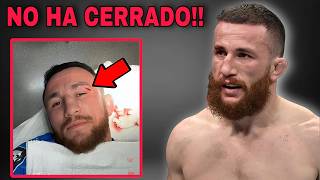 MERAB EN PROBLEMAS VS SEAN O MALLEY ufc [upl. by Rebmac]