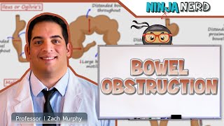 Bowel Obstruction  Clinical Medicine [upl. by Iamhaj829]