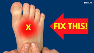 How to Fix Pain on the TOP of the Foot [upl. by Oza]