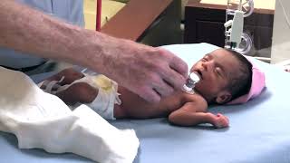 Stanford Doctors Physical Examination of a Premature Infant [upl. by Anitsyrc]