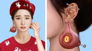 ASMR Remove Big Acne amp Worm Infected Ears  Deep Cleaning Animation [upl. by Selma]