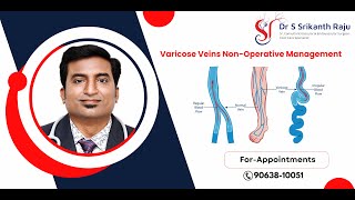 Varicose Veins NonOperative Management  DrSSrikanth Raju  Vascular Surgeon  Hyderabad [upl. by Nahsar756]