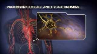 Neurogenic Orthostatic Hypotension  Medical Animation [upl. by Rosinski376]