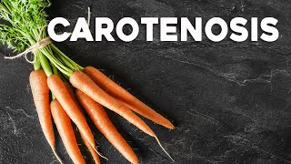 How Too Many Carrots Can Turn Your Skin Orange  Carotenosis  Corporis [upl. by Darreg]