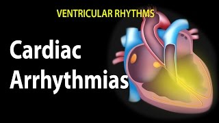 Cardiac Arrhythmias Animation [upl. by Ehtnax]