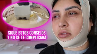 CÓMO SON LOS PRIMEROS 15 DIAS DESPUÉS DE UNA ABDOMINOPLASTIA Y LIPOESCULTURA TODOS LOS TIPS AQUÍ [upl. by Eamaj418]