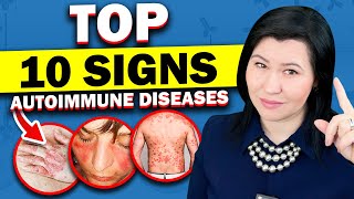 Top 10 Signs of Autoimmune Diseases  A Rheumatologists Guide [upl. by Enileuqaj]