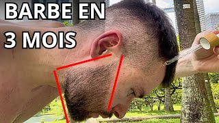 Pourquoi le Minoxidil Conflugain est la solution pour faire pousser ta barbe rapidement [upl. by Tesil90]