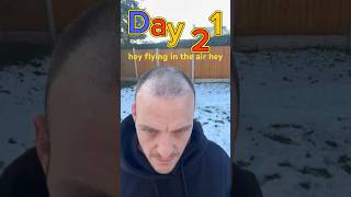 Day 21 Join My Hair Transplant Journey Real Results amp Recovery [upl. by Yellat]