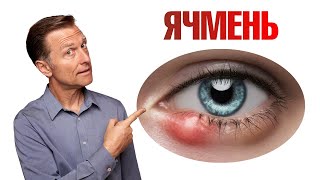 Как избавиться от ячменя на глазу раз и навсегда👁 [upl. by Nolaj111]