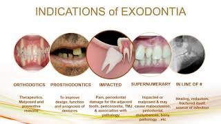 indication and contraindication of exodontia [upl. by Atkins458]