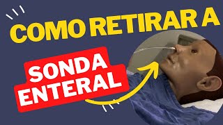 Técnica de Retirada de Sonda Nasoenteral simples e rápido nasctreinamentosenfermagem enfermagem [upl. by Harold]