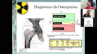 AULA DENSITOMETRIA ÓSSEA  PARTE 01 [upl. by Eenitsed638]