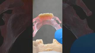 TCS FiberFlex Partial tcsdentalinc tcsdentalinc dental teeth smile lsk121shorts shortvideo [upl. by Gnaht]