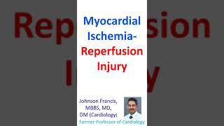 Myocardial IschemiaReperfusion Injury [upl. by Laveen]